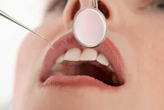 Endodoncia en Medellín