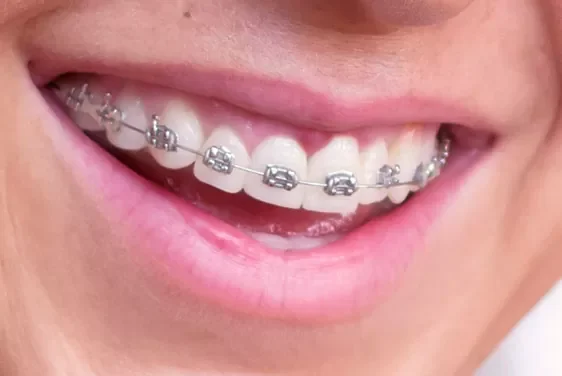 Urgencias odontológicas Medellín