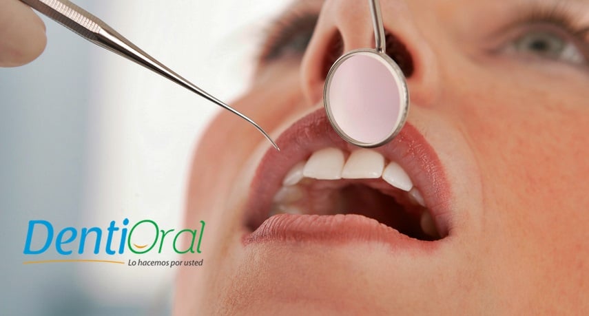 Lo que debes hacer en una emergencia dental