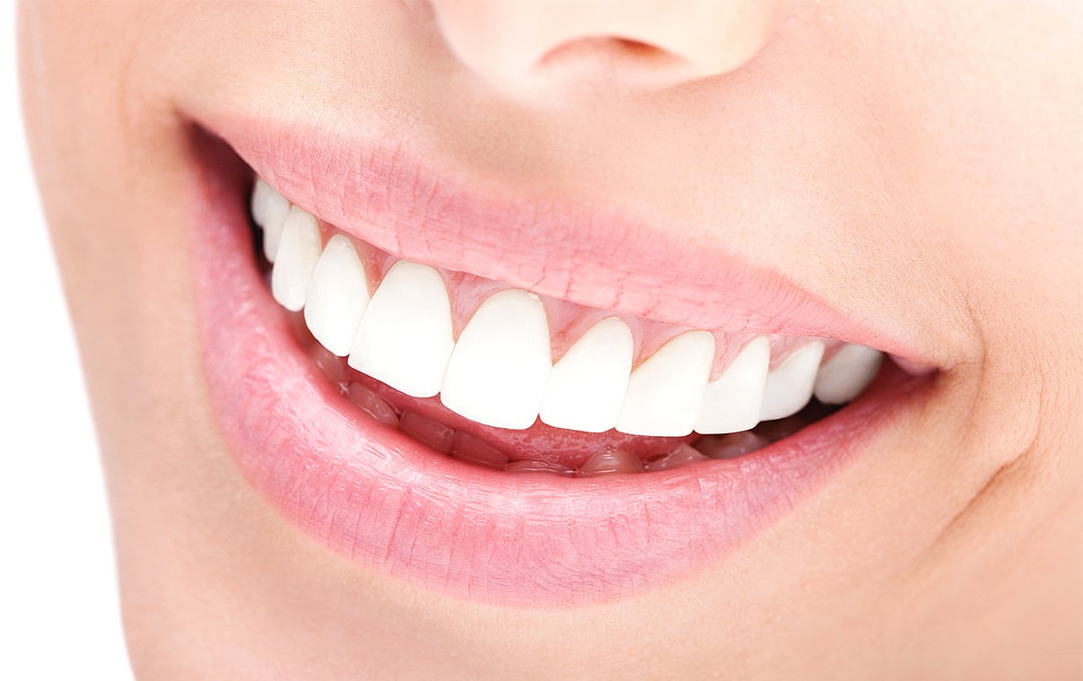 ¿En qué consiste el rejuvenecimiento dental?