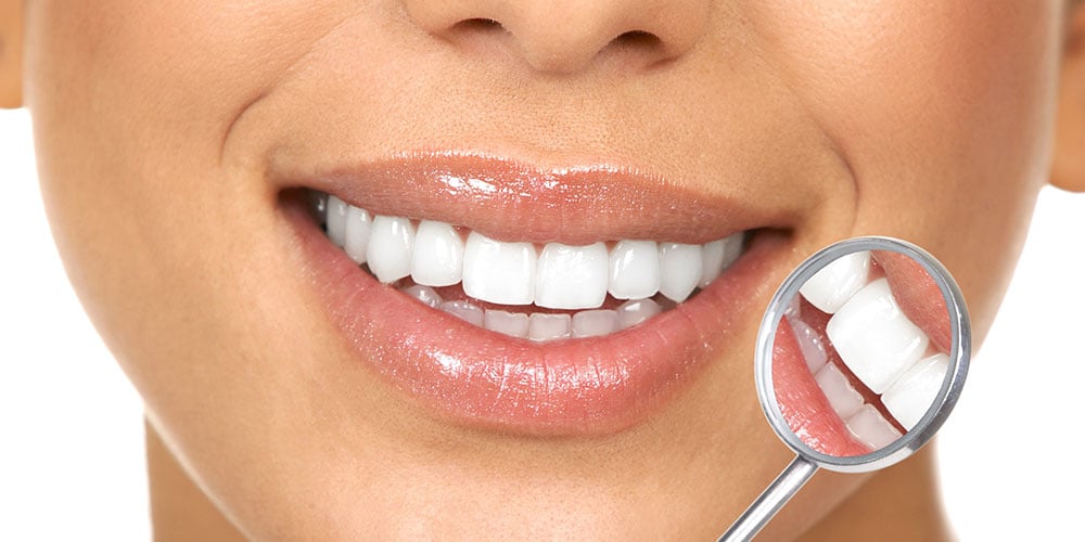 ¿Qué es el diseño de sonrisa?