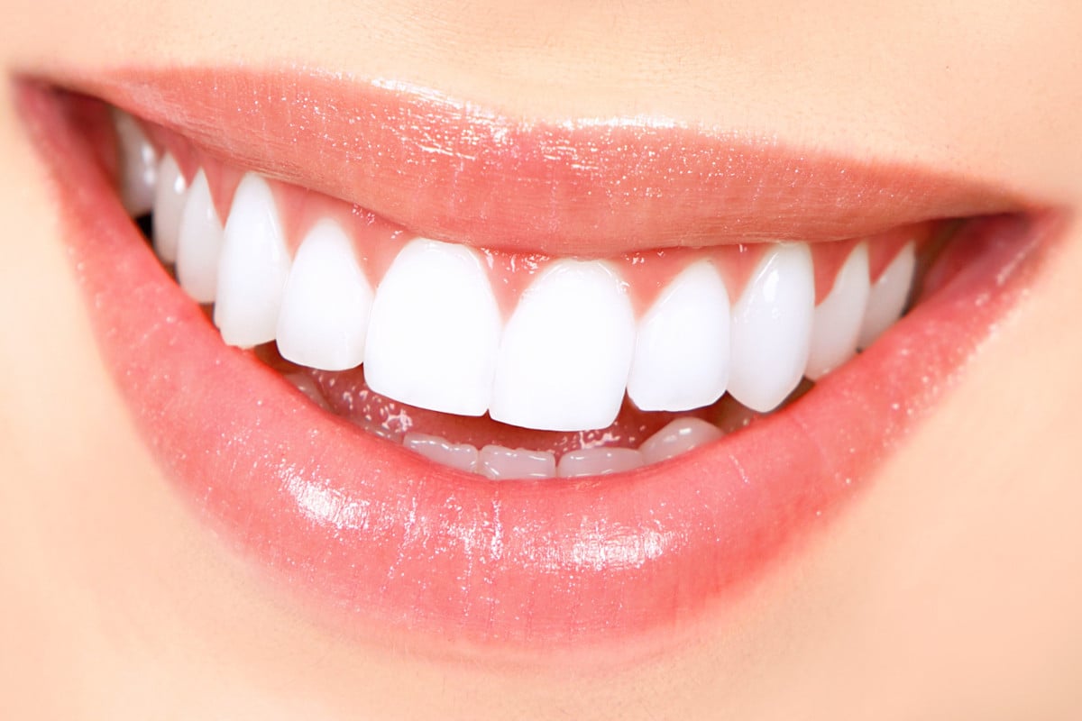 Ventajas del blanqueamiento dental