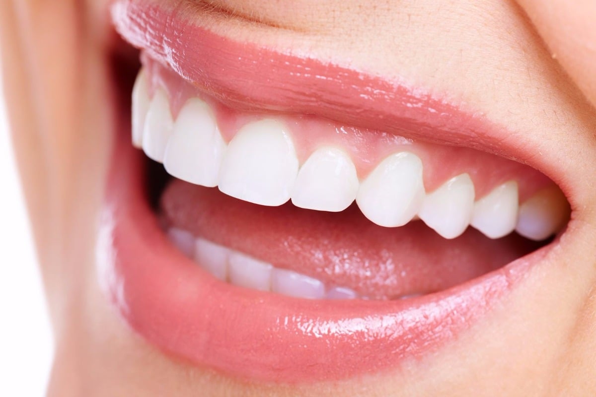 ¿Para qué sirven los implantes dentales?