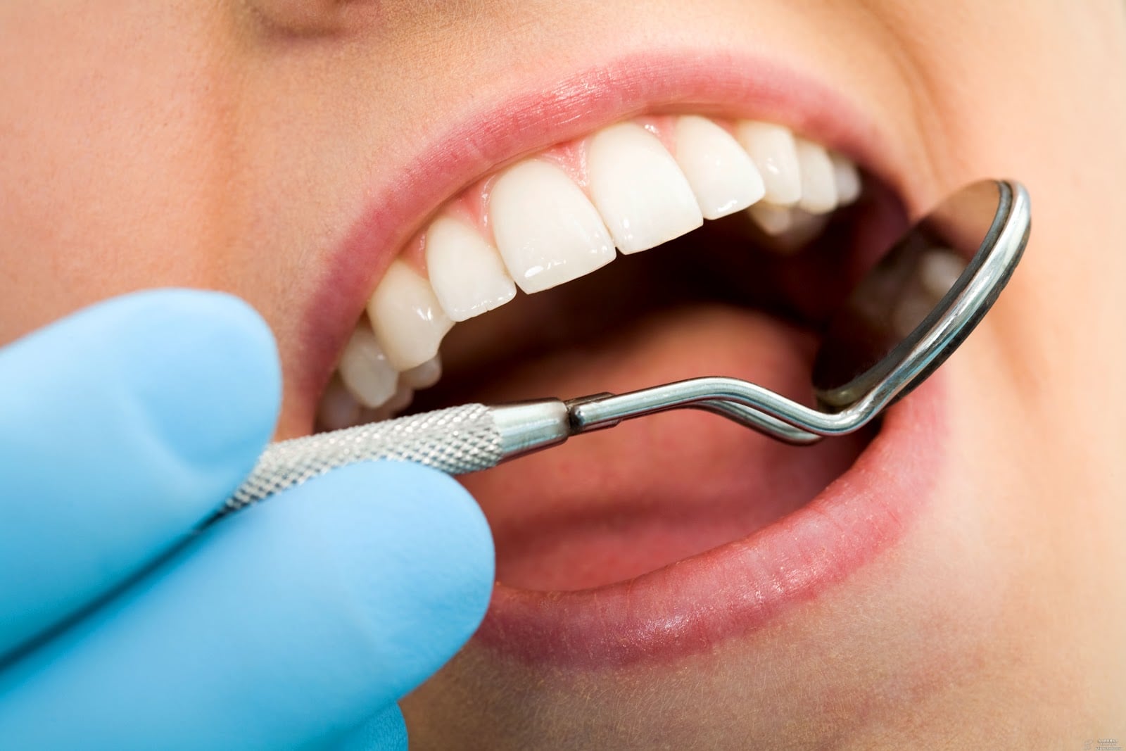 ¿Prótesis dentales fijas o removibles?
