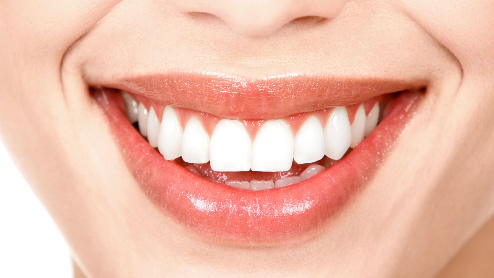Diseño de sonrisa: ¿moda o necesidad?