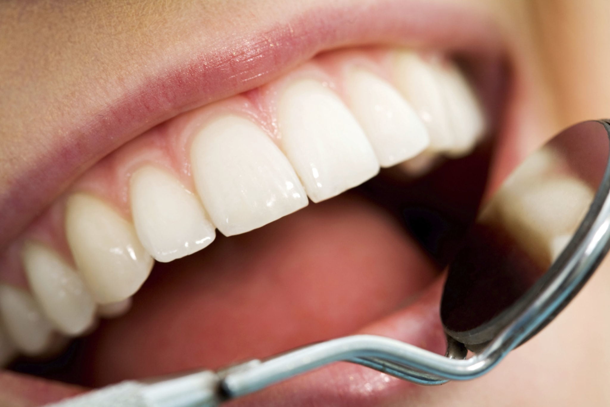 ¿Qué es la endodoncia?