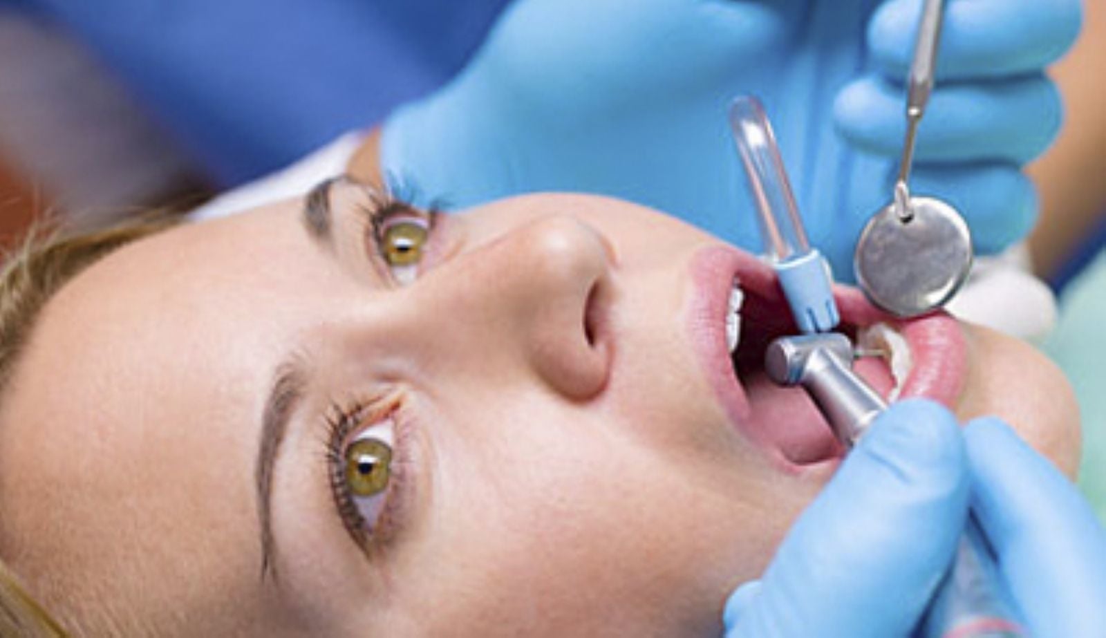 ¿Para qué sirve la endodoncia?