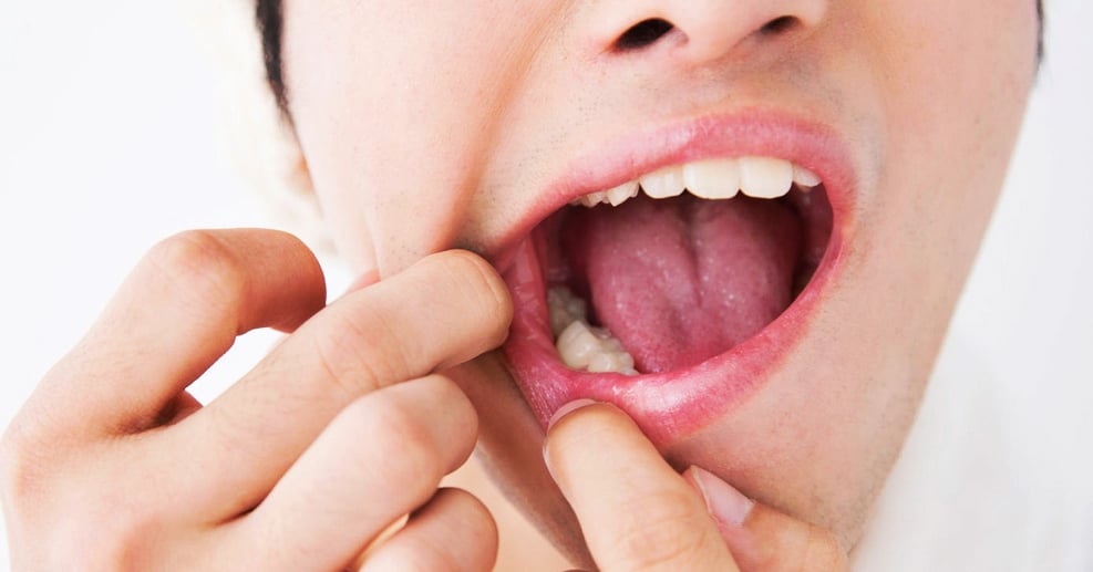 Problemas dentales que debes resolver cuanto antes!