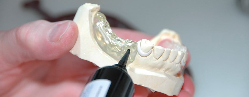 ¿Cuáles son los tipos de prótesis dentales que existen?