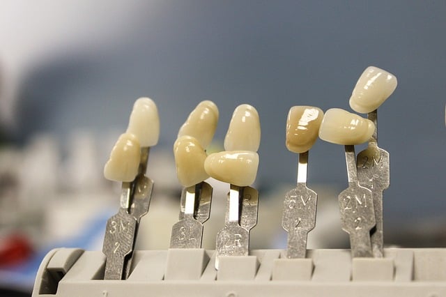 Claves para el éxito de una ortodoncia