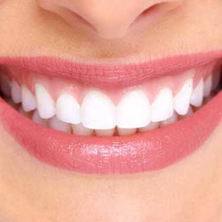 ¿Cuándo son necesarios los implantes dentales?