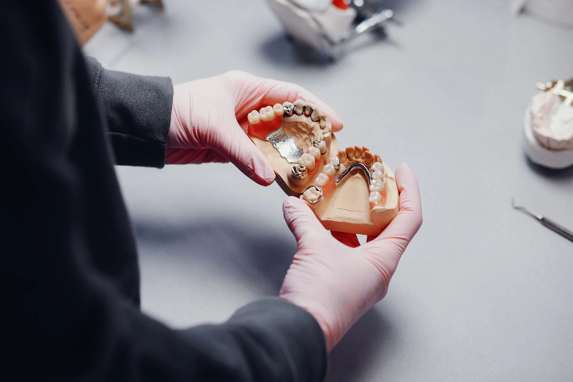 ¿En qué casos se recomiendan los diferentes tipos de restauraciones dentales?