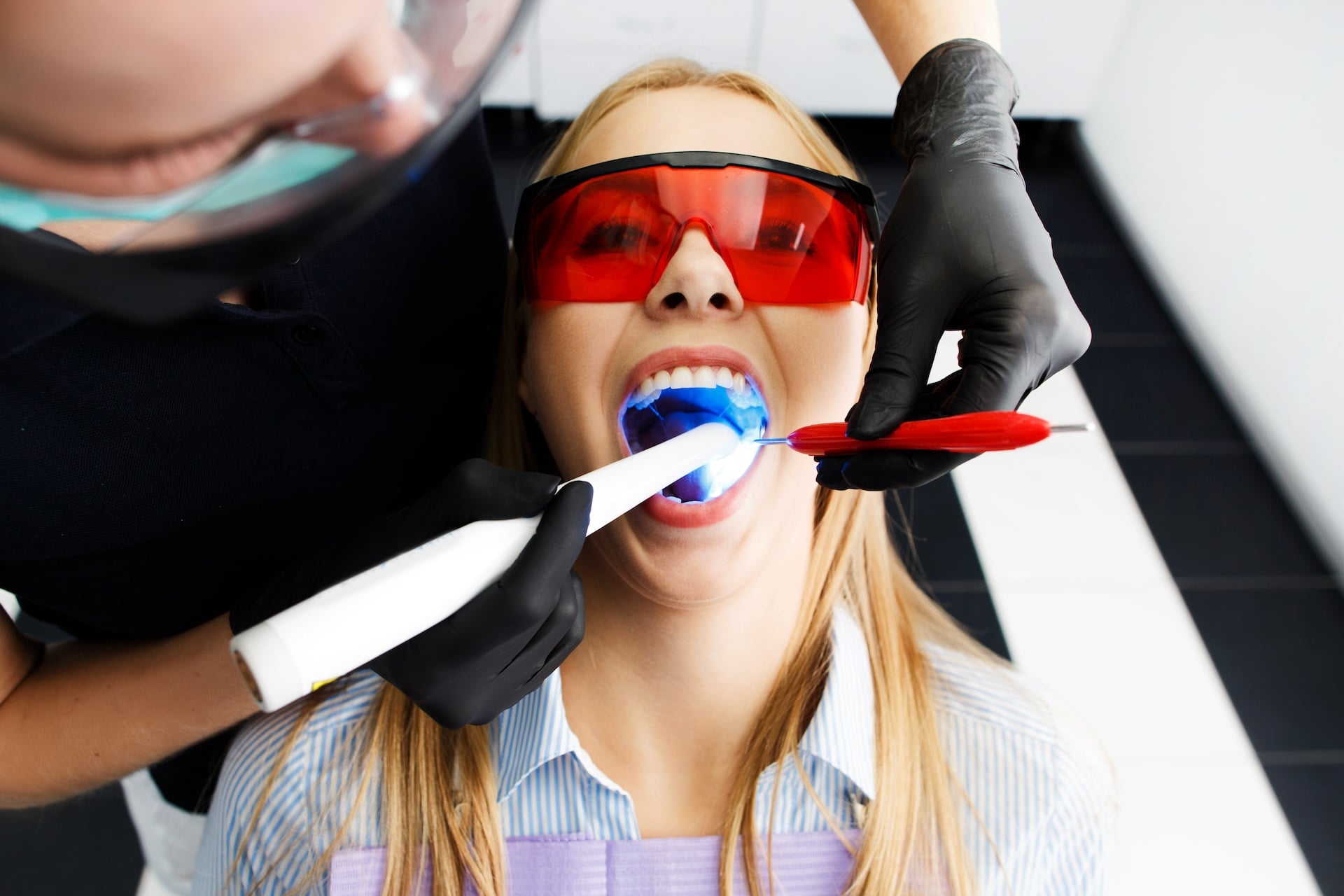 ¿A partir de qué edad se recomienda el blanqueamiento dental?