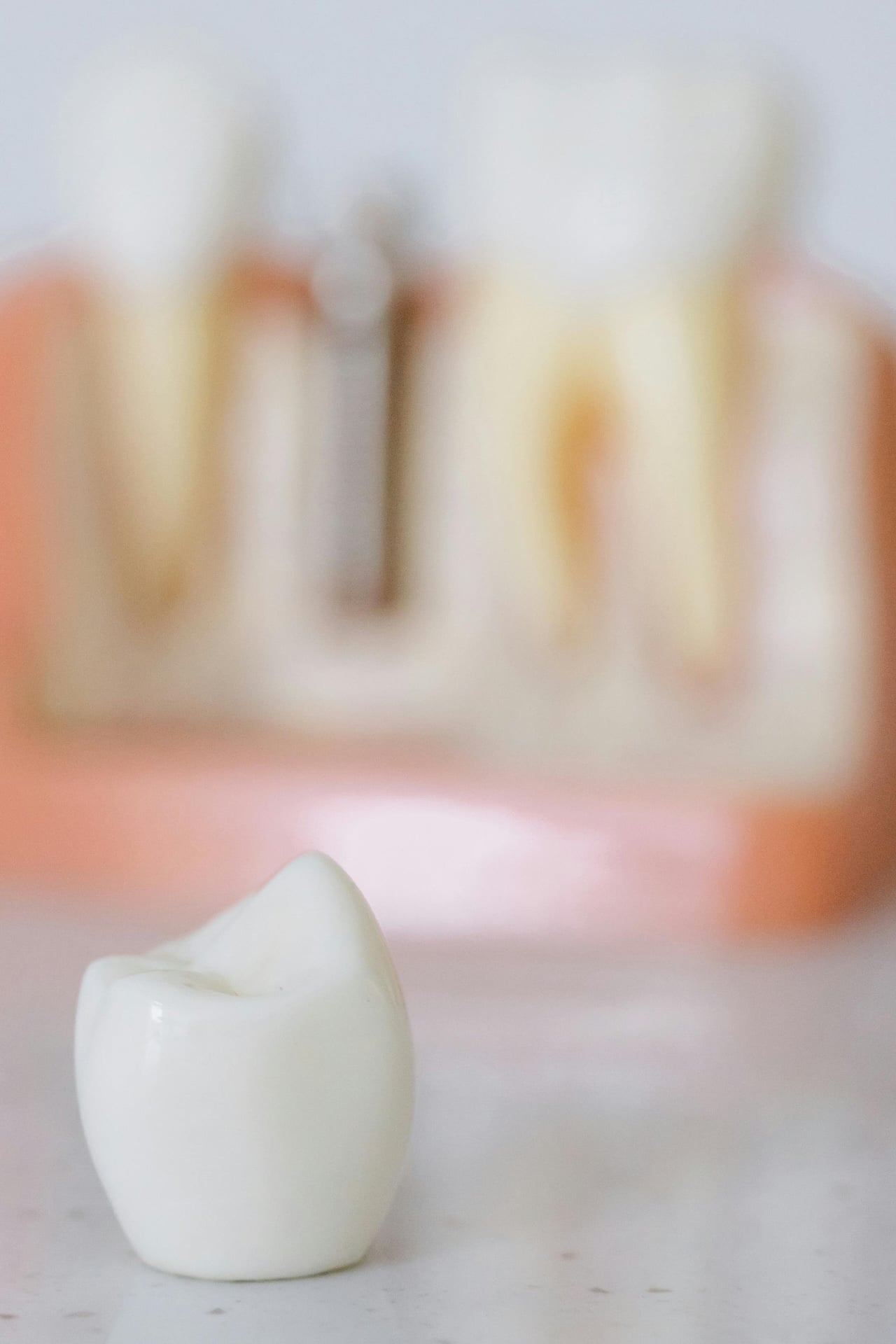 ¿Qué problemas se tratan con implantes dentales y qué opciones de tratamiento hay?