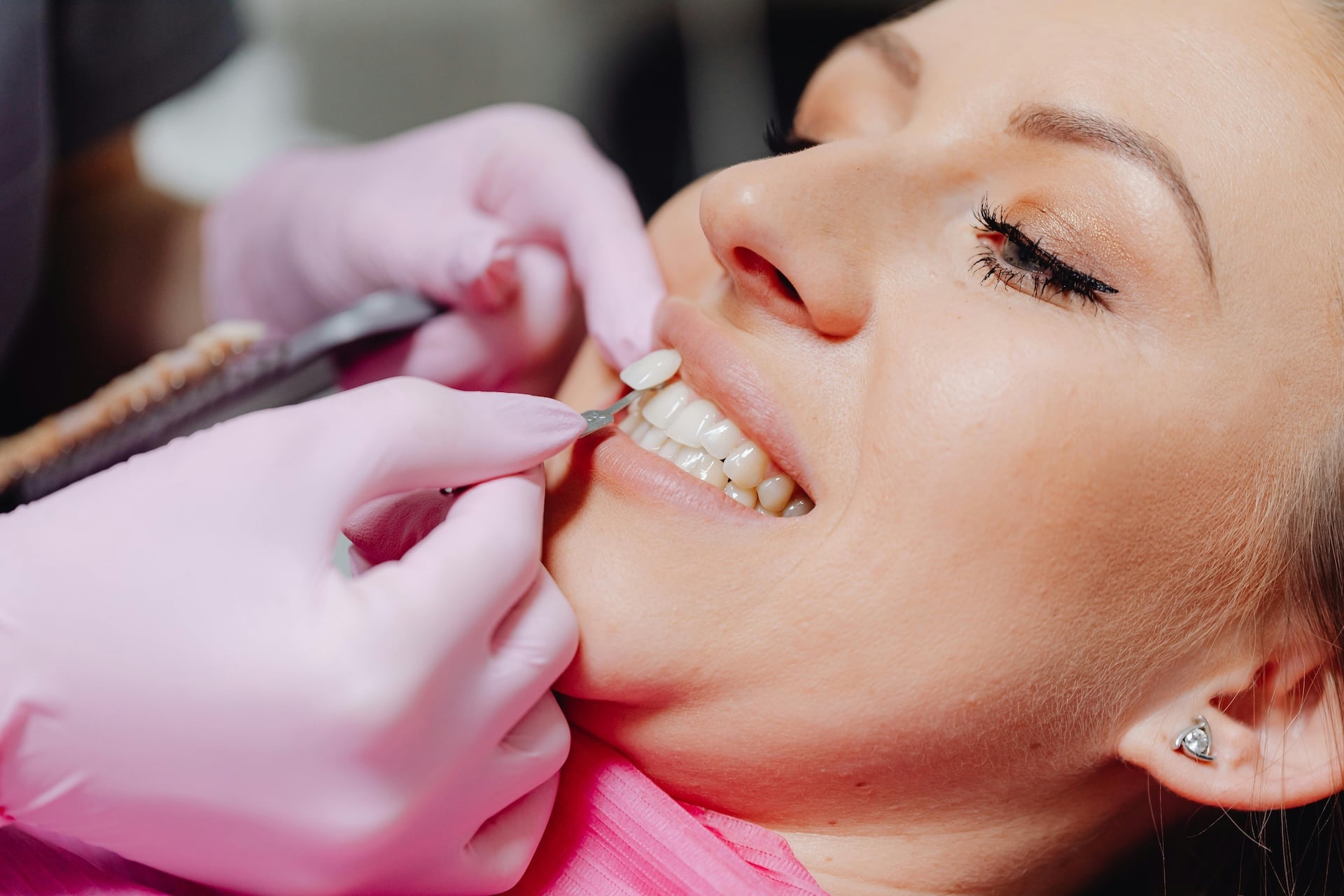 Adiós a los complejos por tus dientes, con carillas dentales en Medellín solucionas este problema.