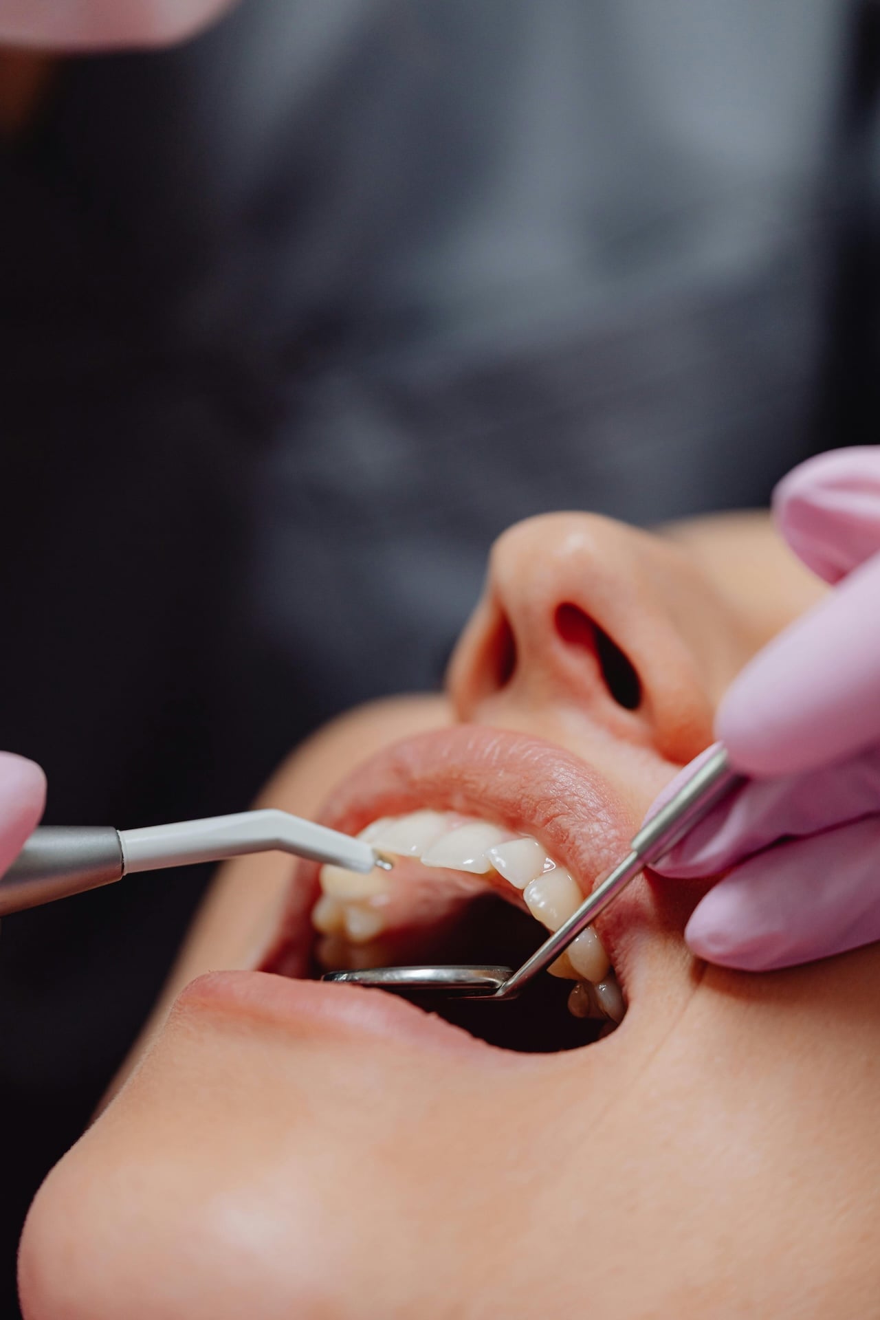 Maloclusión dental en niños: Identificación y soluciones tempranas