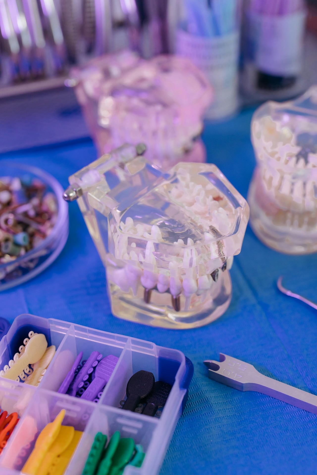¿Qué Brackets de colores son mejores para su caso?