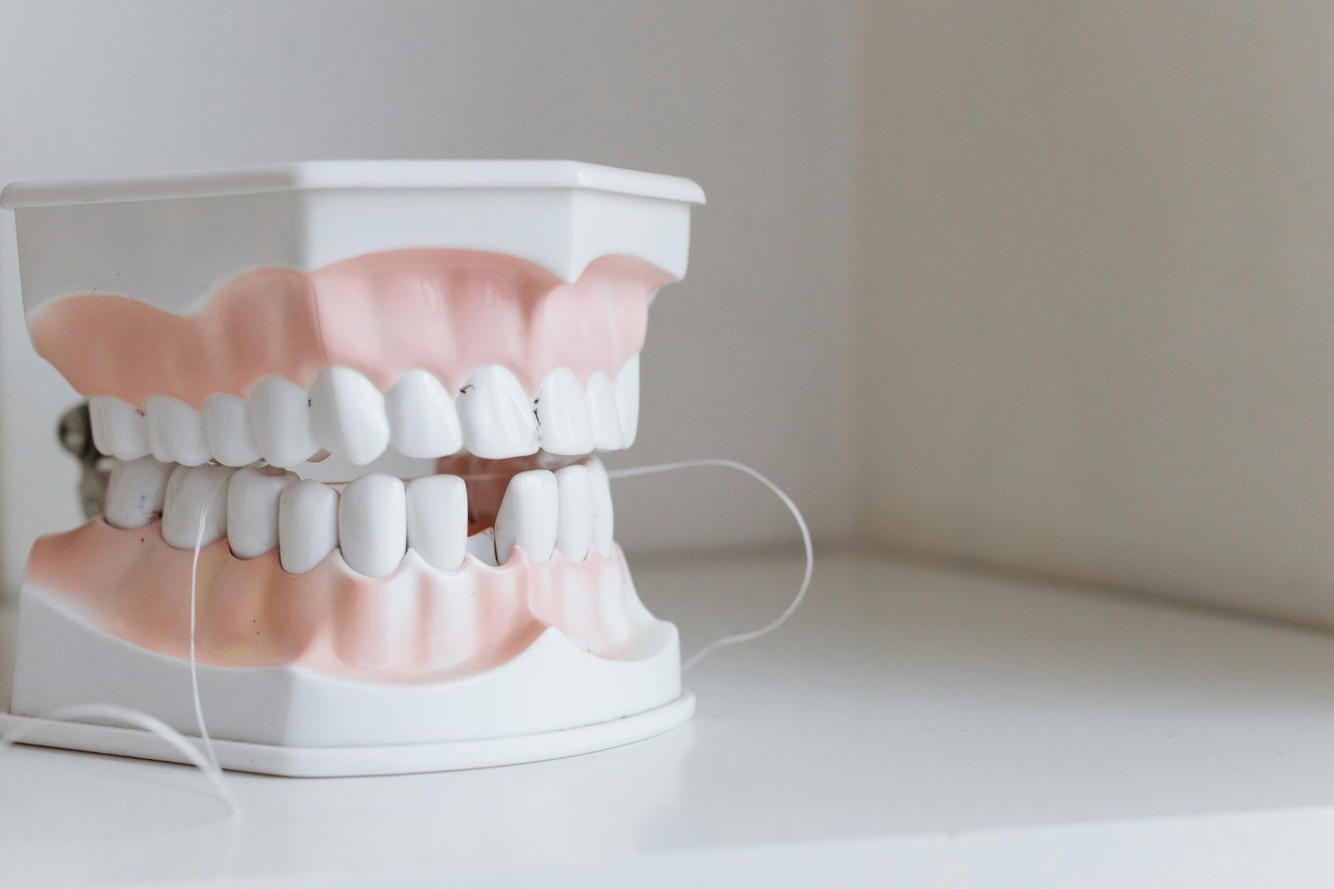 ¿Qué conviene más un blanqueamiento dental casero o profesional?