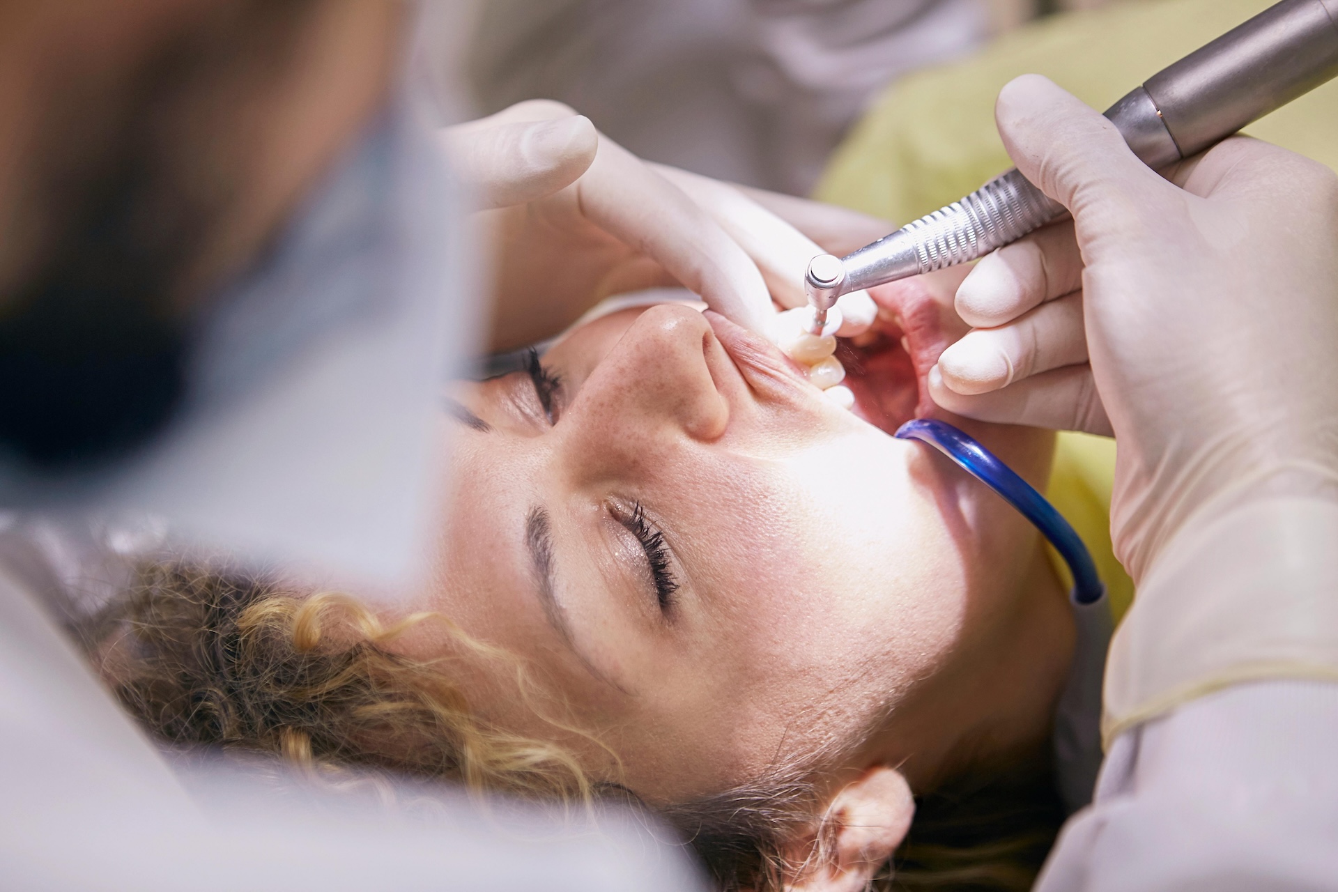 Más allá de la caries: Cuándo se necesita una endodoncia en Medellín